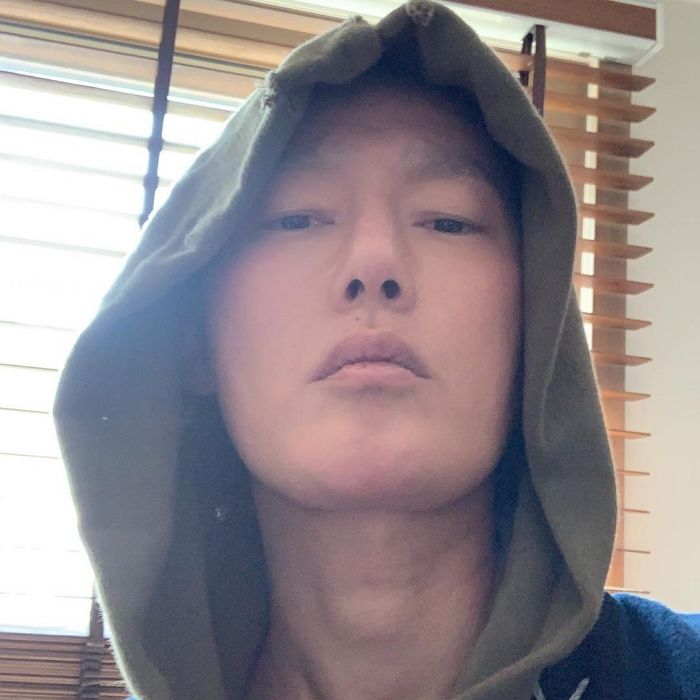 힘든 항암치료 견디며 눈썹 털까지 다 빠진 허지웅