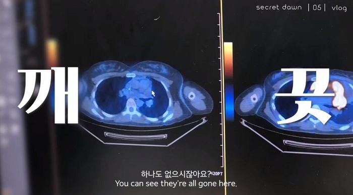 “믿기 힘들 정도”···‘항암치료’ 중인 유튜버 새벽이 전한 기쁜 소식