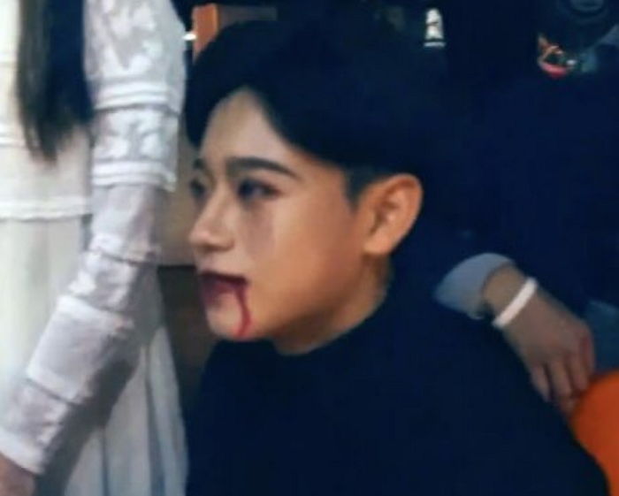 ‘좀비’로 변신하고 귀염뽀짝한 비주얼 폭발시킨 ‘중2’ 금동현