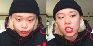 브린 이미지