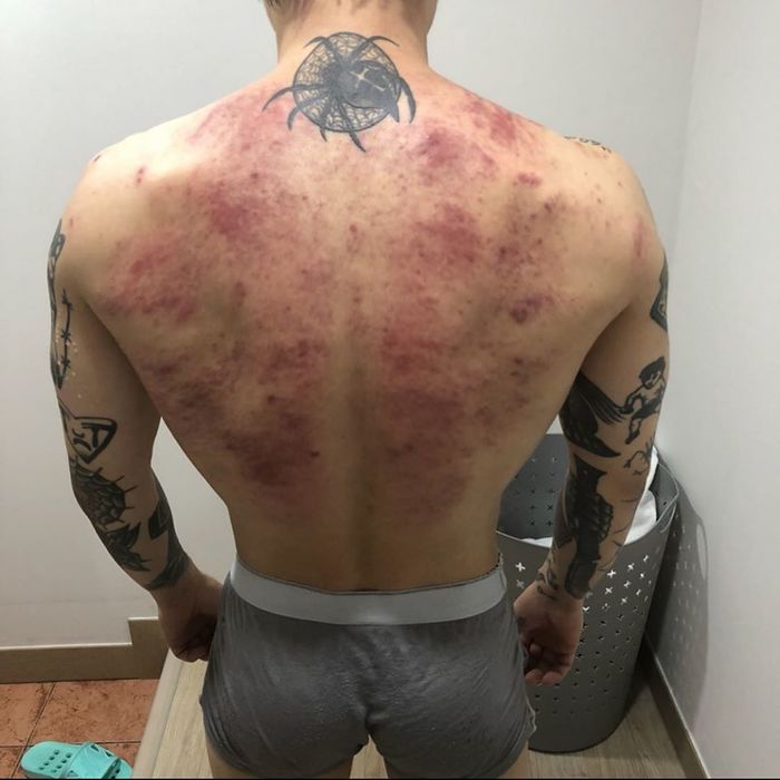 “다구리 앞에 장사 없다”···울긋불긋 멍으로 가득 찬 등 공개한 오늘자 씨잼