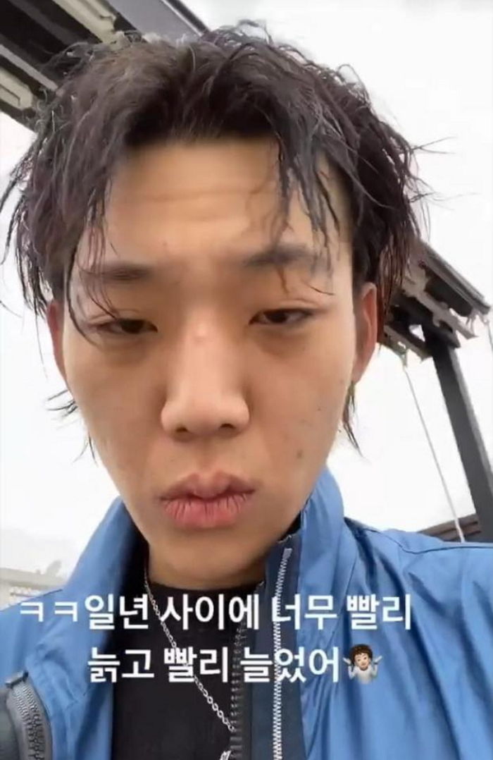 1년 사이 몰라보게 ‘노화’ 온 ‘21살’ 영비