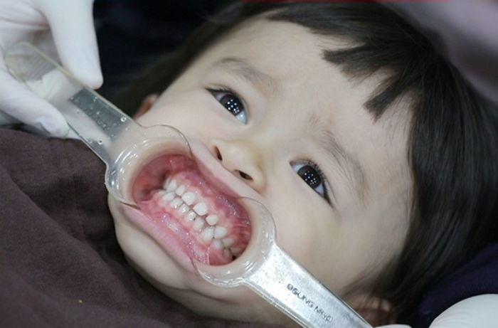 5살 형아 모습 보여주려 무서워도 꾹 참다가 ‘수술’해야된다는 말에 폭풍 오열한 윌리엄