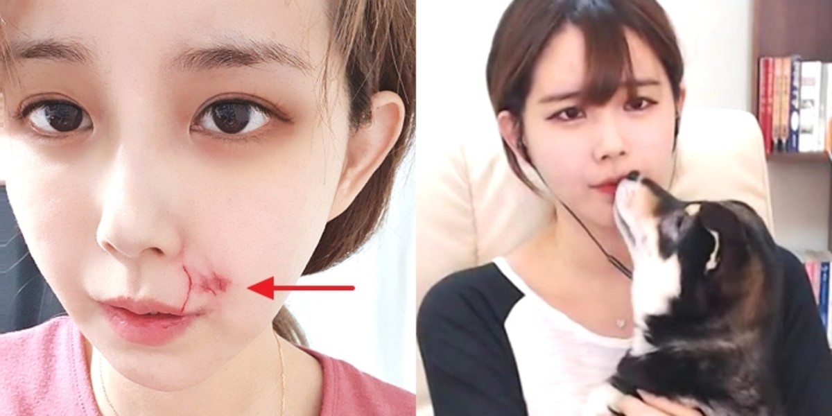 키우는 시바견에 '얼굴' 꽉 물려 버린 '아프리카 4대 여신 ...