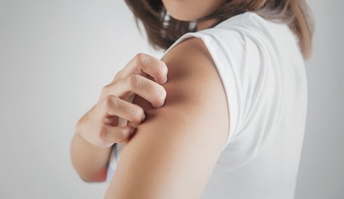 사회적 거리두기로 사람 많이 못 본 모기들, 올 여름 더 극성맞게 달라붙는다