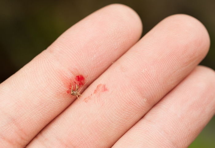 기사와 관련 없는 자료 사진 / gettyimagesBank