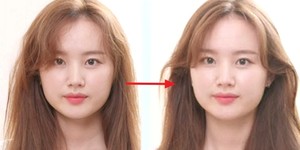 곱슬머리 이미지