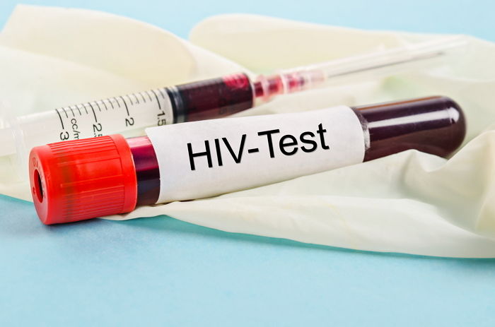 10대·20대 HIV 감염, 8년 전보다 두 배 가까이 늘었다