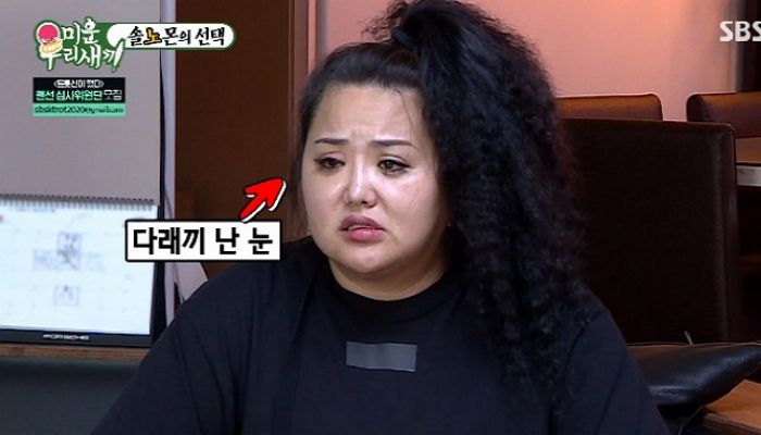 매일 4시간씩 운동하며 다이어트했다더니 눈에 ‘다래끼’ 난 홍선영