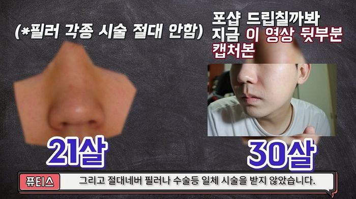 ‘필러·보톡스’ 시술 안 받아도 콧대 확 높일 수 있는 기적의 마사지법