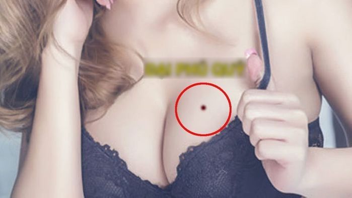“여자친구 가슴에 ‘점’ 있으면 결혼 후 ‘부자’ 된다”
