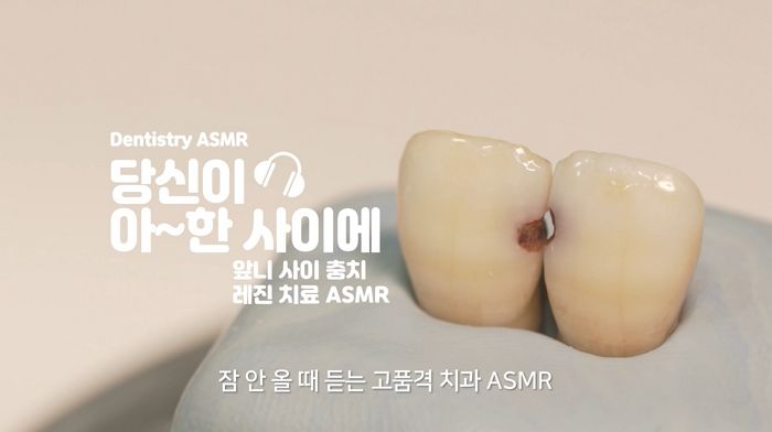 영상 안보고 소리만 들어도 턱 감싸 쥐게 만드는 치과의사의 ‘충치 치료’ ASMR