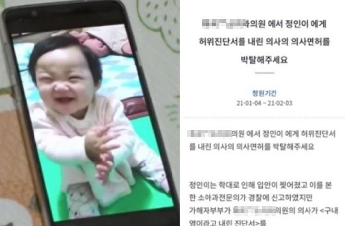 “입 찢어진 정인이 구내염 진단한 의사, 면허 취소하라” 청와대에 올라온 국민청원