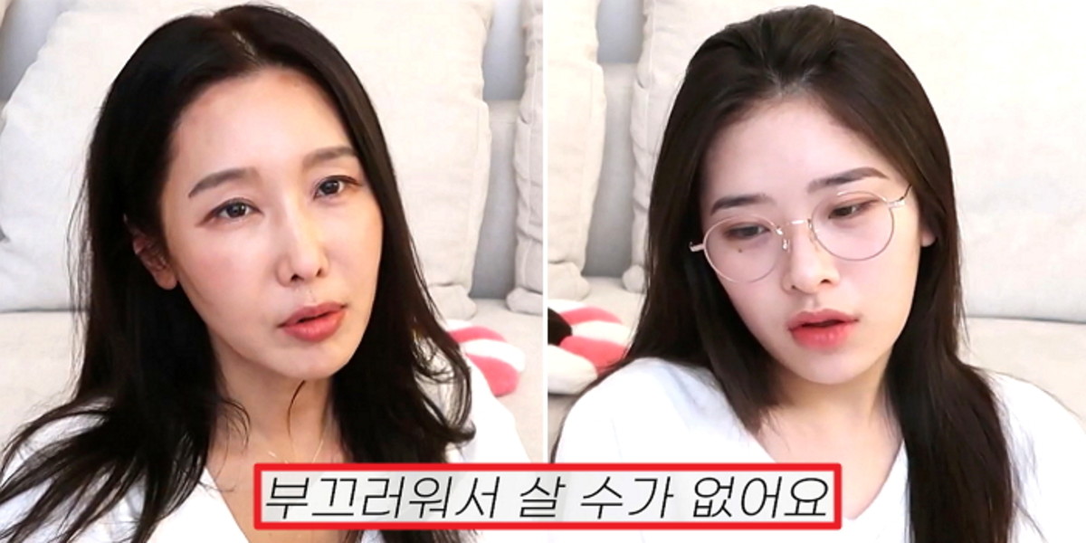 “I’m sorry, Tae-hee”… ’53-year-old dentist’ Lee Soo-jin who finally apologized for saying she was prettier than Kim Tae-hee (video)