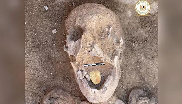 죽은 시신 묻으면서 신과 대화하라고 금으로 혓바닥 만들어준 2000년 전 사람들