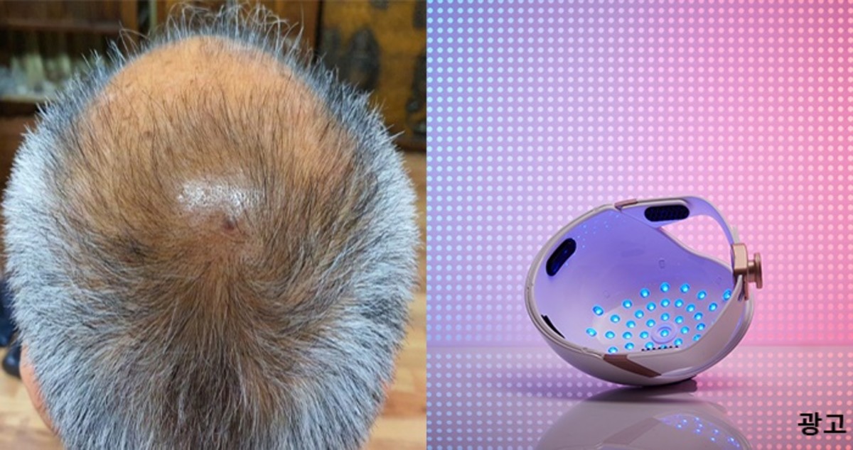 미세전류 활용한 기기류 시장 확대, 국내 최초 ‘미세전류 두피케어기’ 개발