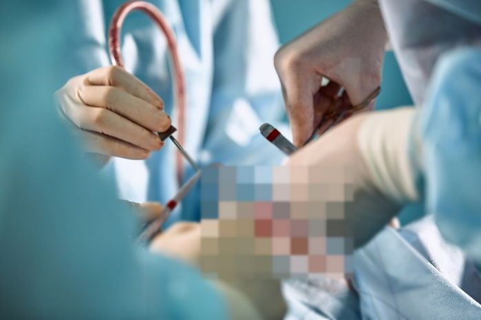 “애 안 낳겠다며 정관수술한 남편, 저는 왜 임신을 했을까요?”