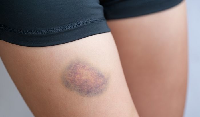 기사의 이해를 돕기 위한 자료 사진 / gettyimagesBank