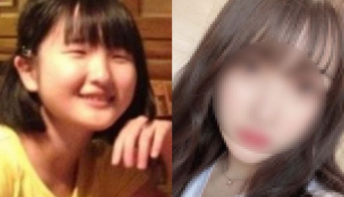 “넌 나 닮아 너무 못생겼어”...놀리는 아빠 말에 성형수술 감행한 16살 소녀의 변화