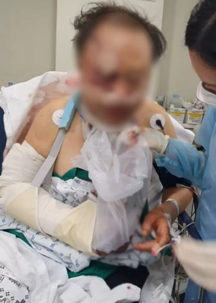 눈이 마주쳤다는 이유로 70대 할아버지 20분동안 폭행한 190cm 거구남