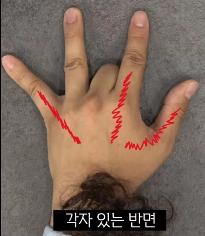 인사이트