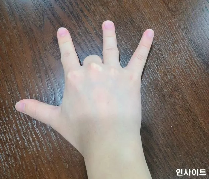 인사이트
