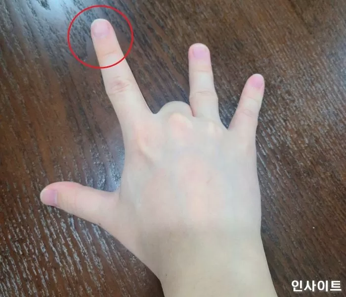인사이트
