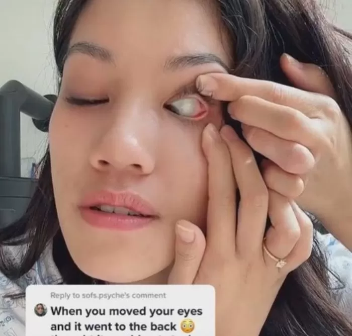 인사이트
