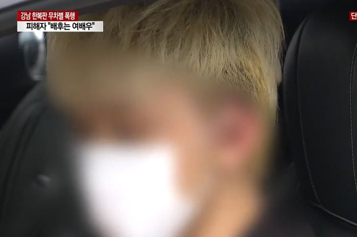 ‘공짜 술’ 달라며 갑질하는 여배우 만행 SNS에 폭로했다가 ‘조폭’에 두들겨 맞은 남성 (영상)