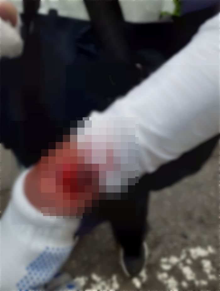 “주차관리하는 ‘80세’ 아버지가 벤츠 탄 남성에게 무참히 폭행당했습니다”