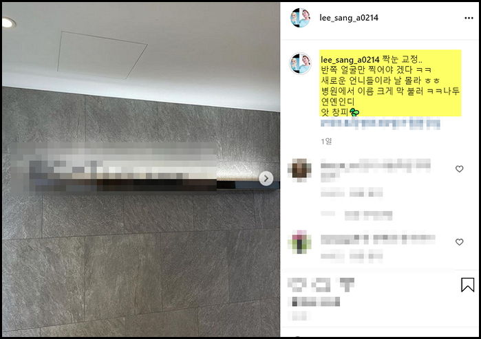 짝눈 교정하러 성형외과 갔다가 이름 크게 불리자 “창피했다” 고백한 이상아