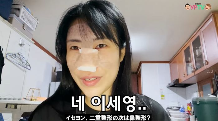 쌍수한지 3달 된 여친이 ‘코 수술’까지 했다고 하자 ‘일본인 연하’ 남친이 보인 반응 (영상)