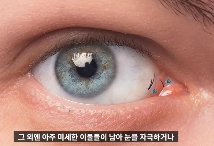 인사이트