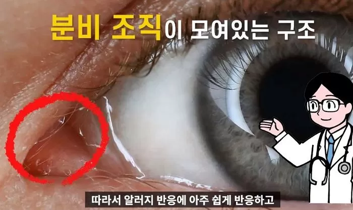 인사이트