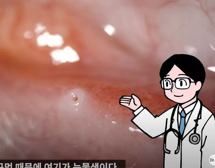 인사이트