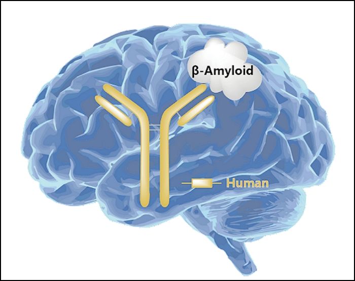 치매 치료·예방할 수 있는 ‘치료제’ 1년 내 출시된다