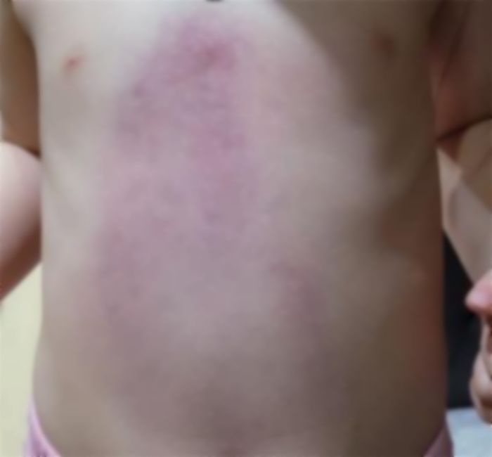 “뱃속에 귀신 가득하다”는 스님 말에 5살 아이 배 피멍 들도록 폭행한 친아빠와 고모