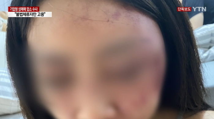 불법체류 여성들 ‘성매매’시키고 때리면서 SNS엔 ‘남친짤’ 올리며 스윗남 행세한 남성