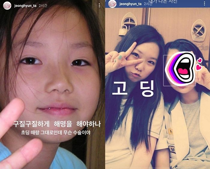 성형 루머 돌자 학창 시절 ‘과거 사진’ 싹 다 공개해 ‘자연 미인’ 인증한 아나운서