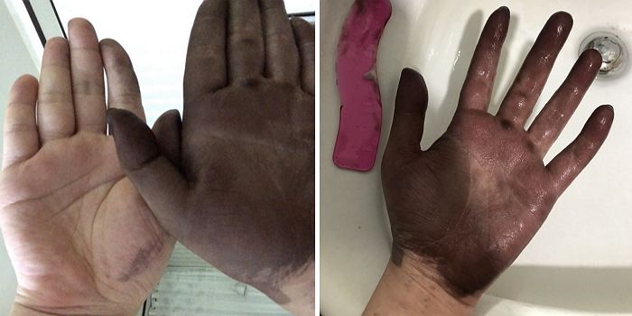 집에서 ‘셀프염색’하다 손까지 새카맣게 물들여버린 남성 (사진)