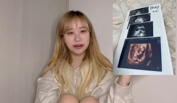 21살 유튜버 조두팔, 임신 5개월 깜짝 고백...“태명은 우정이”