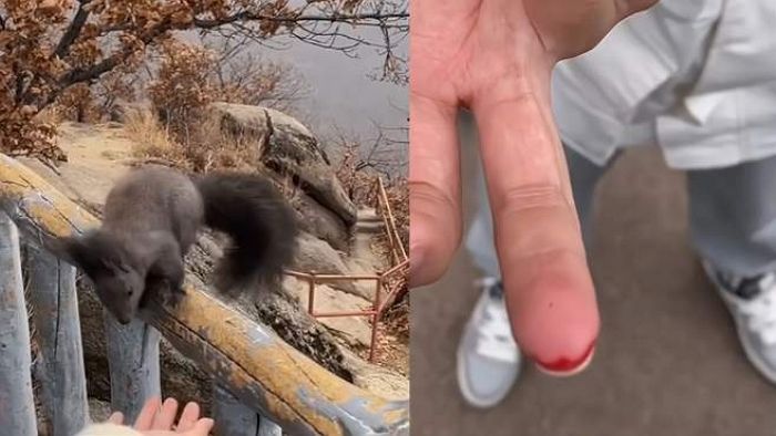 산에서 만난 청설모 귀여워 손 내밀었다가 물려 피 철철 난 여성