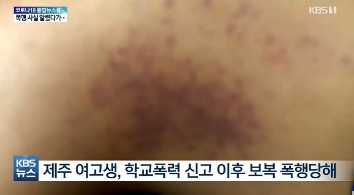 ‘학교폭력’ 신고한 여고생 알아내 ‘보복 폭행’한 10대들
