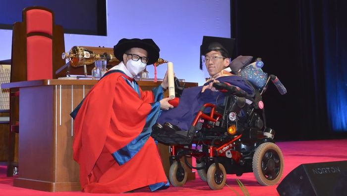희귀병 때문에 2살까지 밖에 못 산다던 아이, 의사 진단 뒤집고 대학교 졸업