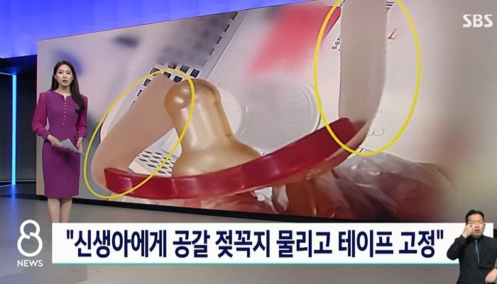 태어난 지 이틀 된 아기 입에 공갈젖꼭지 테이프로 붙인 대학병원 신생아실