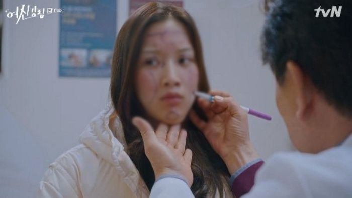 대학교 수시 합격 후 ‘눈코 성형’하겠단 딸을 울린 아빠의 호통