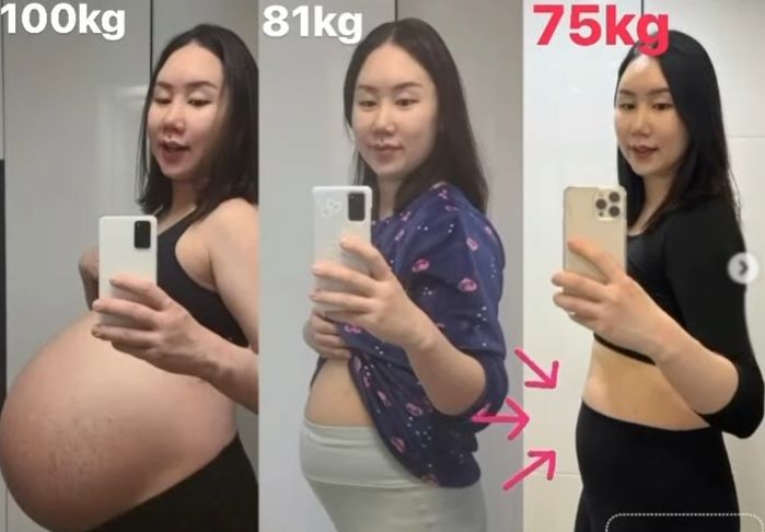 ‘삼둥이’ 낳은지 3개월 만에 ‘100kg→75kg’로 감량한 개그우먼 황신영