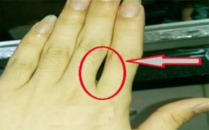 손가락 오므렸을 때 검지와 중지 사이에 ‘틈’ 생기는 사람은 커서 ‘부자’ 된다