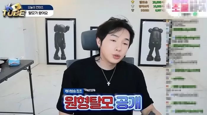 ‘코인게이트’ 논란 후 동전 크기 ‘원형탈모’ 처음 공개한 BJ 케이