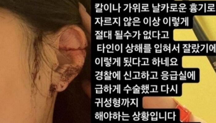 “강남 OO클럽에서 누군가 흉기로 제 귀를 싹둑 잘라버렸습니다”